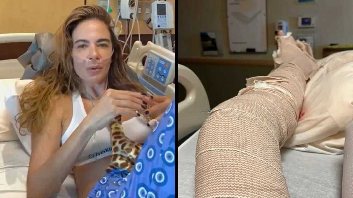 Luciana Gimenez em hospital nos Estados Unidos, após acidente